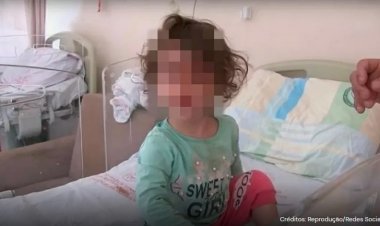 Criança de 2 anos mata cobra com mordida após ser picada por ela