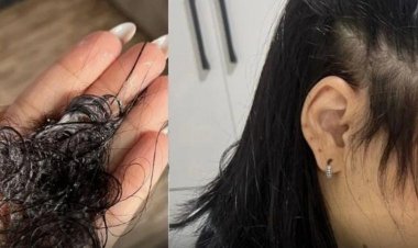 Mulheres denunciam queda de cabelo após tratamento de beleza em salão de Santa Luzia