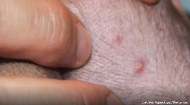 Cachorro testa positivo para varíola dos macacos após dormir com tutores infectados