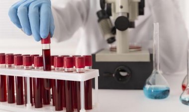 Saiba qual tipo sanguíneo é associado a um risco 18% maior de derrame antes dos 60 anos