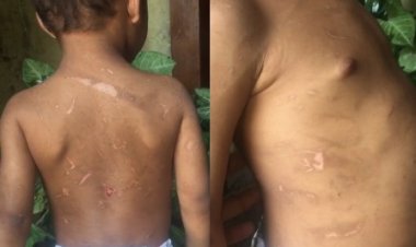Mãe de menino de 3 anos acusa madrasta de maus-tratos contra ele, em Paraopeba