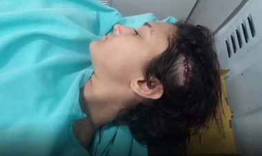 Jovem é agredida na cabeça com madeira, após crítica a Bolsonaro, em bar: "Vai apanhar que nem homem"