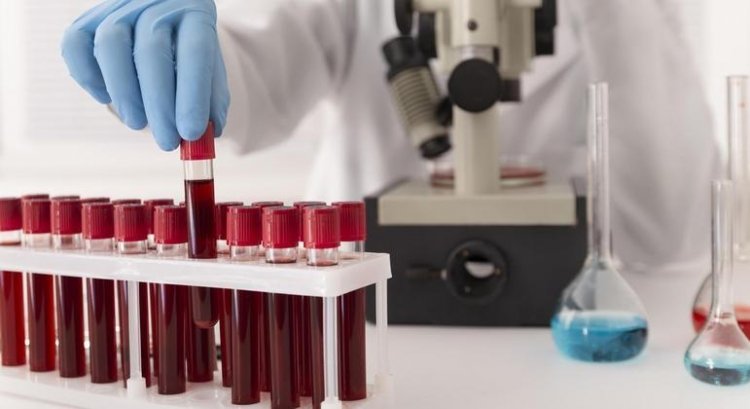 Saiba qual tipo sanguíneo é associado a um risco 18% maior de derrame antes dos 60 anos