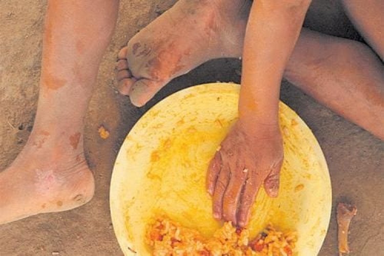 Minas Gerais tem 1,7 milhão de pessoas sem ter o que comer