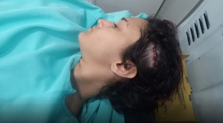 Jovem é agredida na cabeça com madeira, após crítica a Bolsonaro, em bar: "Vai apanhar que nem homem"