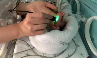 Pesquisadores da UFMG criam aparelho com luz de LED para ajudar prematuros