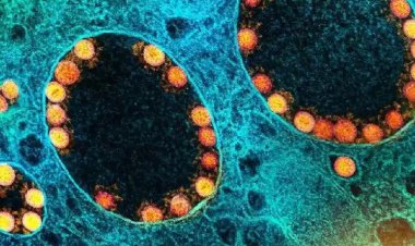 BQ.1: o que se sabe sobre variante da ômicron descoberta no Brasil