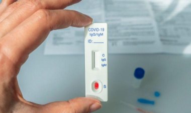 Boletim epidemiológico confirma mais 58 casos de Covid-19 em Sete Lagoas