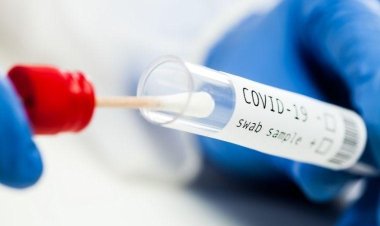 Boletim Epidemiológico - Sete Lagoas ultrapassa 46 mil casos de Covid-19 desde o início da pandemia