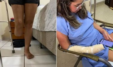 Mulher tem perna e dedos amputados depois de lipoaspiração