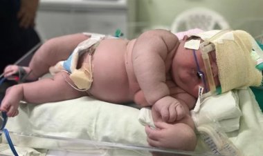Impressionante: 'Bebê Gigante' nasce com mais de 7 kg