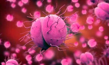 Casos de 'super gonorreia' resistente a antibióticos preocupa comunidade médica