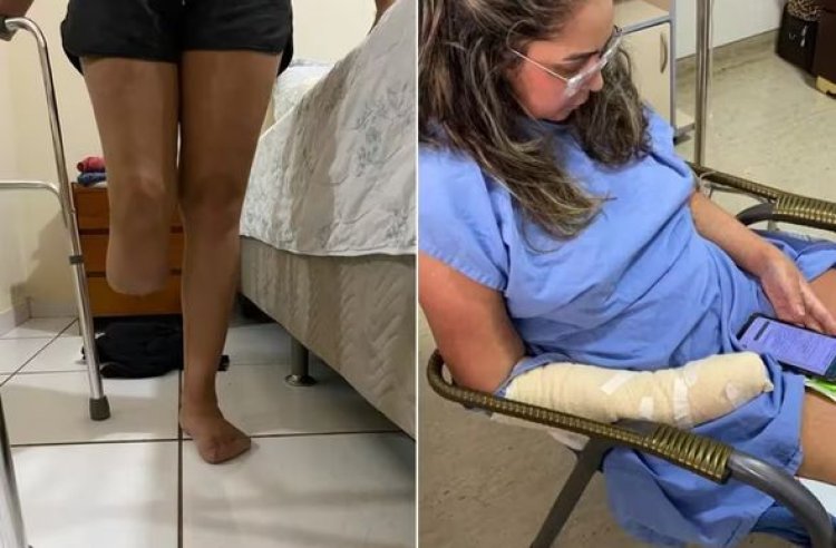 Mulher tem perna e dedos amputados depois de lipoaspiração