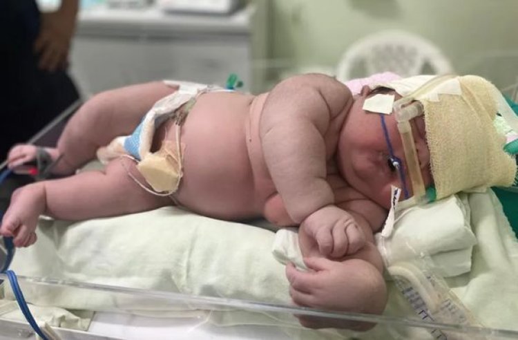 Impressionante: 'Bebê Gigante' nasce com mais de 7 kg