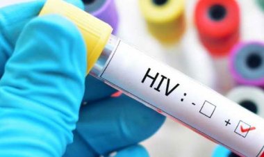 Transplante de medula óssea cura o HIV em mais um paciente, anunciam cientistas