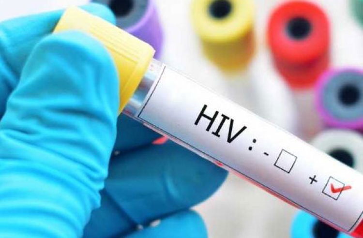 Transplante de medula óssea cura o HIV em mais um paciente, anunciam cientistas