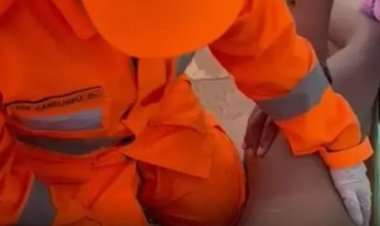 Menino tem cabelo sugado por ralo de piscina e é socorrido em estado grave em MG