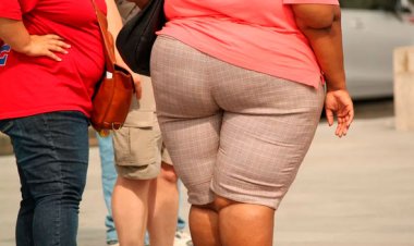 Obesidade deve atingir 41% da população global até 2035, indica Atlas