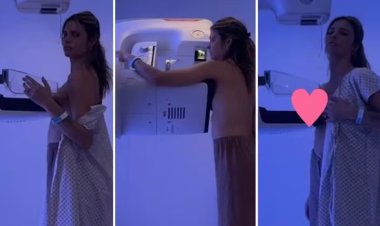 Fernanda Lima mostra exame de mamografia e reforça: 'Prevenção, cuidado, saúde da mulher'