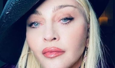 Madonna conta que esteve em coma durante recente internação