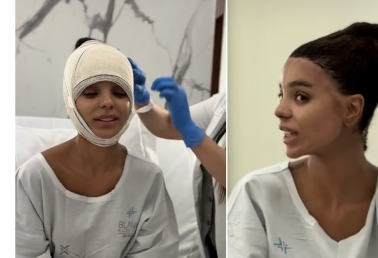 Veja o antes e o depois da frontoplastia de Brunna Gonçalves