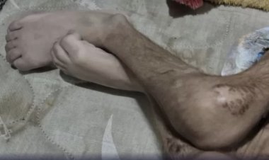 Criança com paralisia cerebral é encontrada morta em Sete Lagoas (MG); mãe e padrasto são presos