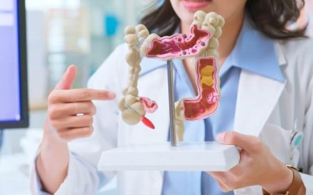 Câncer de intestino em jovens: estudo aponta as principais causas