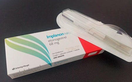 Planos de saúde passam a cobrir Implanon, contraceptivo de alta eficácia