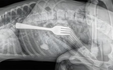 Mulher engole garfo inteiro durante refeição e vai parar no hospital