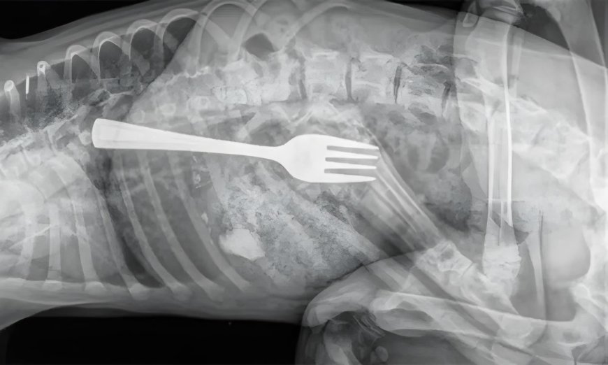 Mulher engole garfo inteiro durante refeição e vai parar no hospital