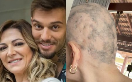 Mãe de Lucas Lucco desabafa sobre alopecia