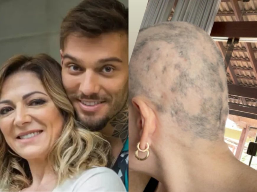 Mãe de Lucas Lucco desabafa sobre alopecia