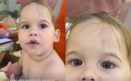 José Leonardo, filho de Virginia, é mordido na escola