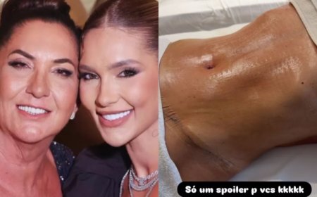 Virginia conta que presenteou a mãe com plásticas