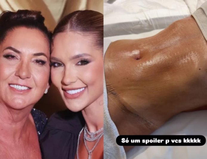 Virginia conta que presenteou a mãe com plásticas