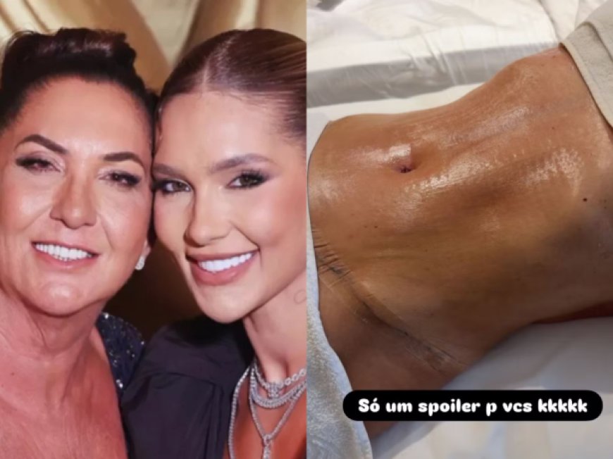 Virginia conta que presenteou a mãe com plásticas